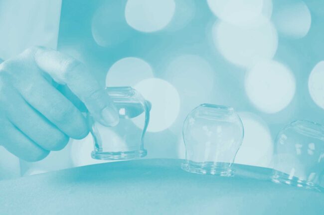 Formation à la technique de ventouses - cupping therapy - hijama