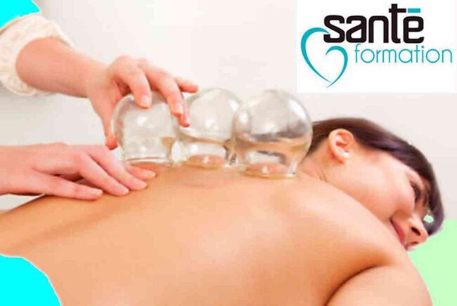 Technique des ventouses