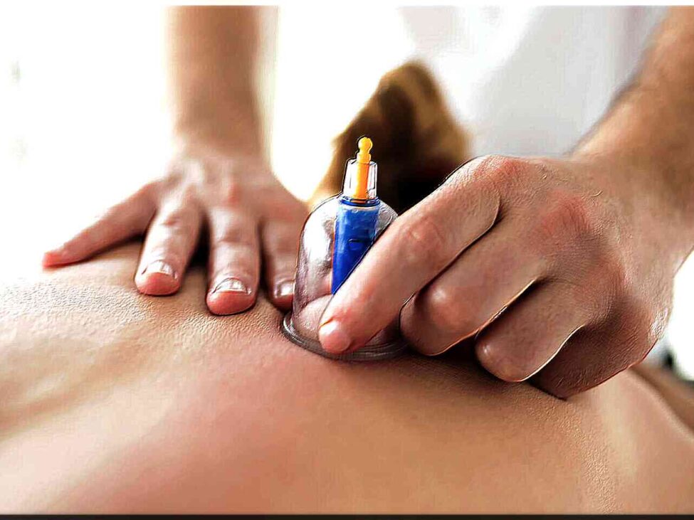 ventouses techniques ventouses