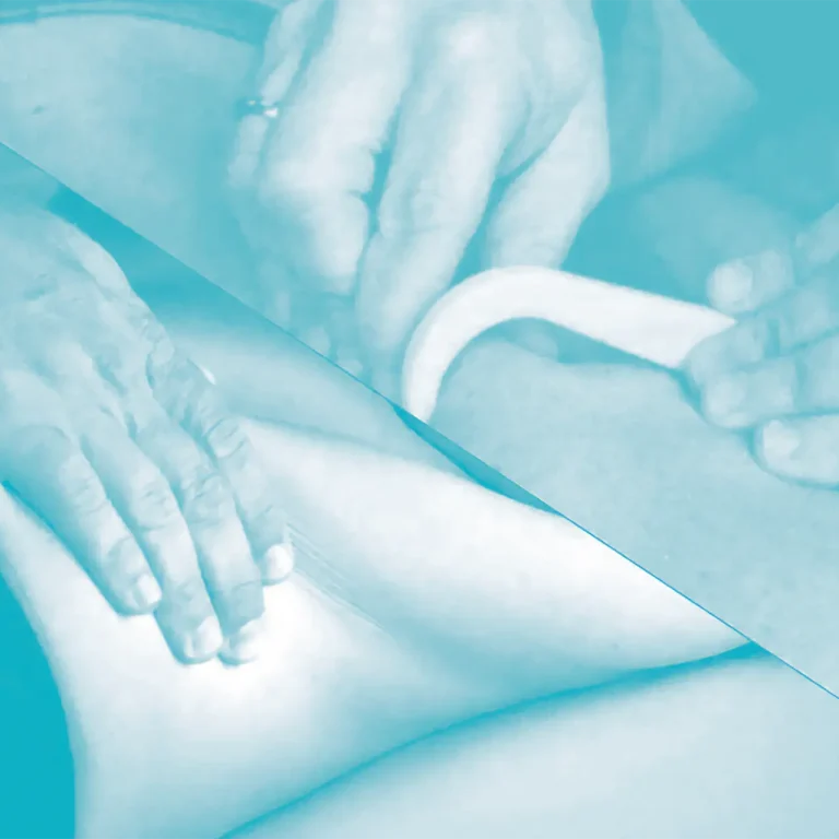 Traitement des tensions myofasciales par la mobilisation du tissu conjonctif (fascias) en manuel et avec crochets