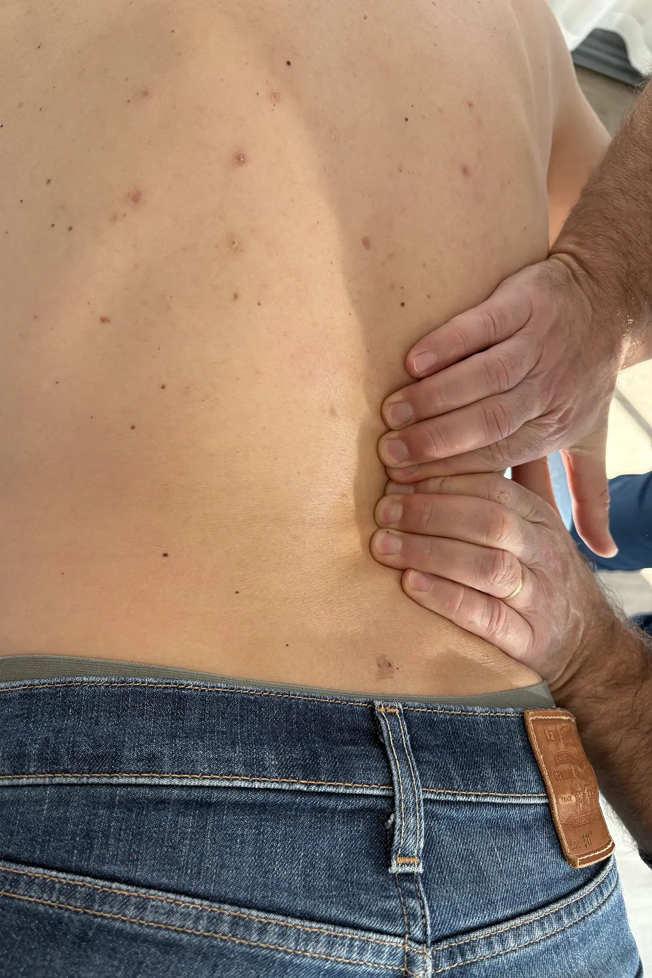 Thérapie manuelle lombo-sacrée au sein du groupe EMEIS Thérapie manuelle lombo-sacrée au sein du groupe EMEIS