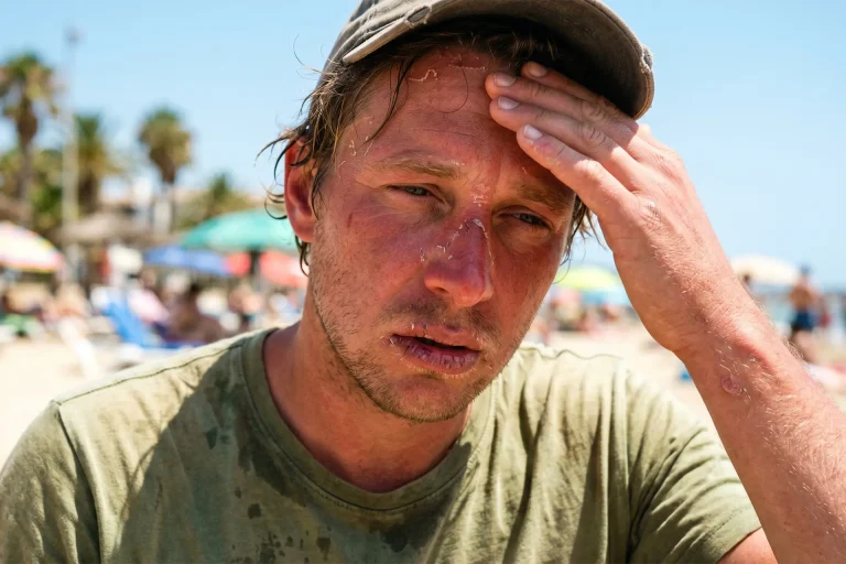 Les dangers du soleil et le rôle du kinésithérapeute dans la prise en charge des patients